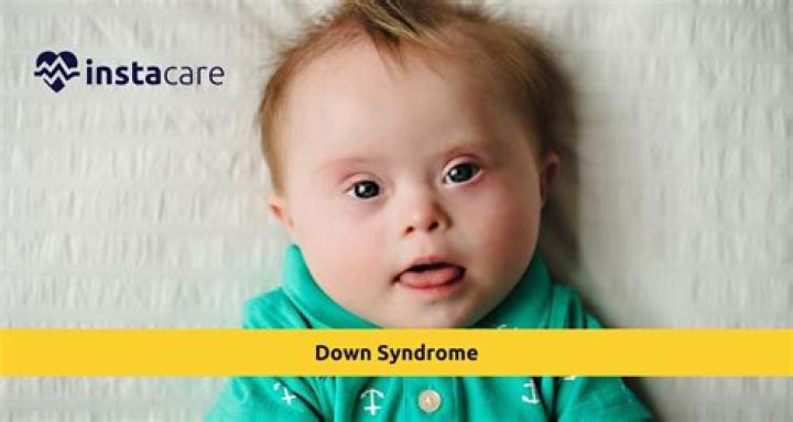 
Harry Maguire Health Update And Illness | Is He Diagnosed With Down Syndrome 